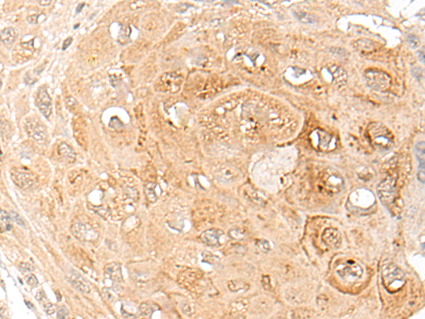 Rabbit Polyclonal Antibody to CST1