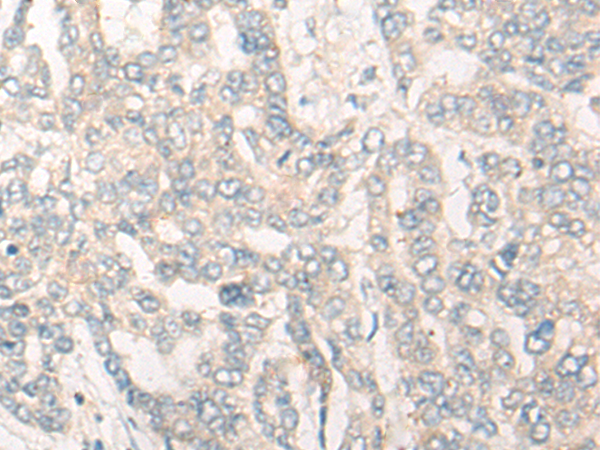 Rabbit Polyclonal Antibody to CYP26B1