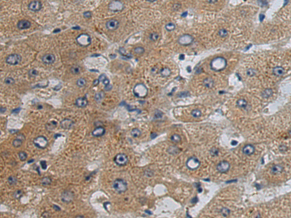 Rabbit Polyclonal Antibody to CYP2J2
