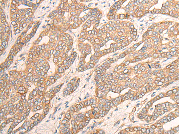 Rabbit Polyclonal Antibody to DYNC1LI1