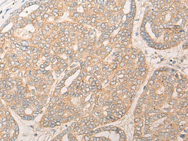 Rabbit Polyclonal Antibody to DAOA