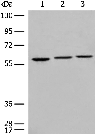 Rabbit Polyclonal Antibody to TKFC