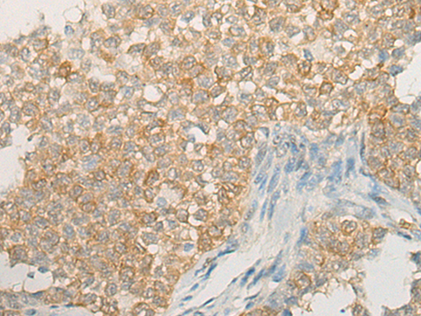Rabbit Polyclonal Antibody to DACT2