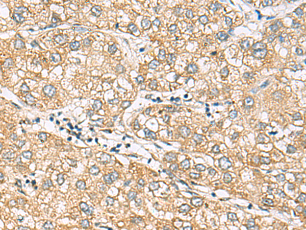 Rabbit Polyclonal Antibody to DACT3