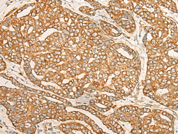 Rabbit Polyclonal Antibody to DARS1