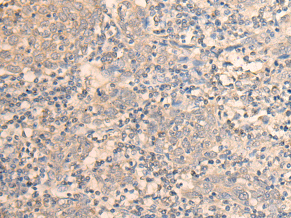 Rabbit Polyclonal Antibody to DAZ1