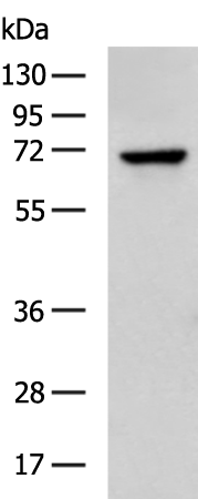 Rabbit Polyclonal Antibody to DCP1B