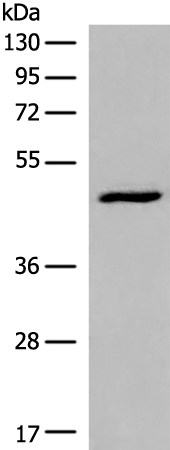 Rabbit Polyclonal Antibody to DCP2