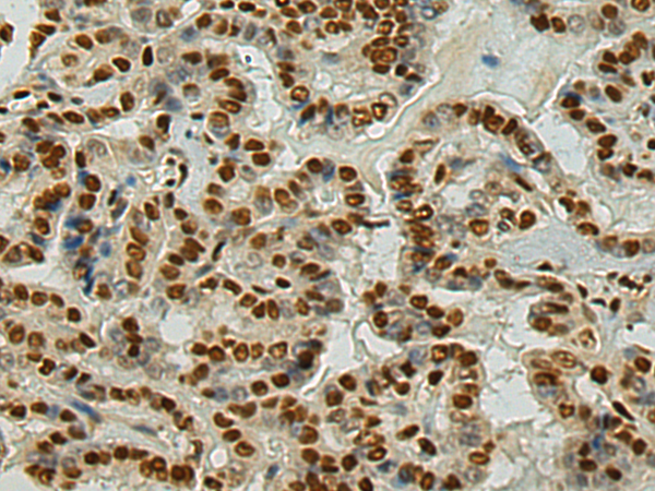 Rabbit Polyclonal Antibody to DCPS