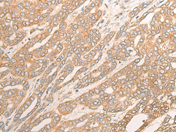 Rabbit Polyclonal Antibody to DCTD