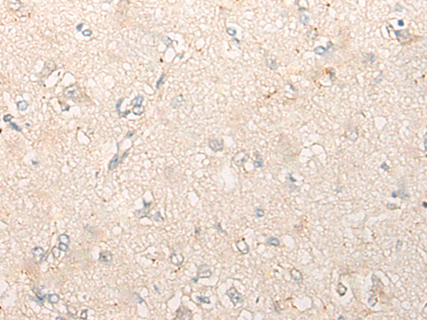 Rabbit Polyclonal Antibody to DDA1