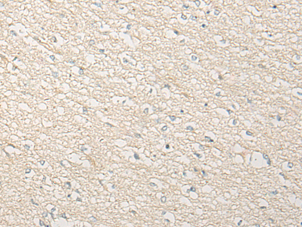 Rabbit Polyclonal Antibody to DDI1
