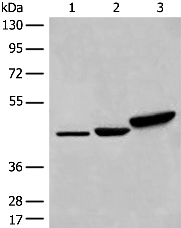 Rabbit Polyclonal Antibody to DDOST