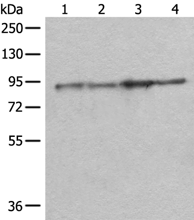 Rabbit Polyclonal Antibody to DDX1