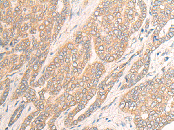 Rabbit Polyclonal Antibody to DDX19A