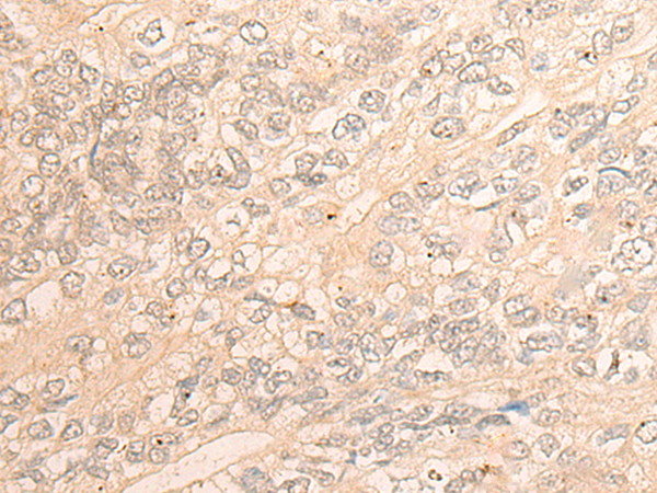 Rabbit Polyclonal Antibody to DDX21