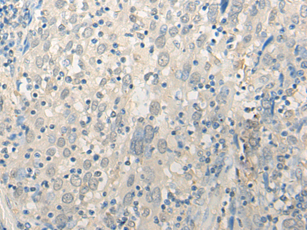 Rabbit Polyclonal Antibody to DDX23