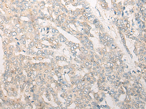 Rabbit Polyclonal Antibody to DDX24