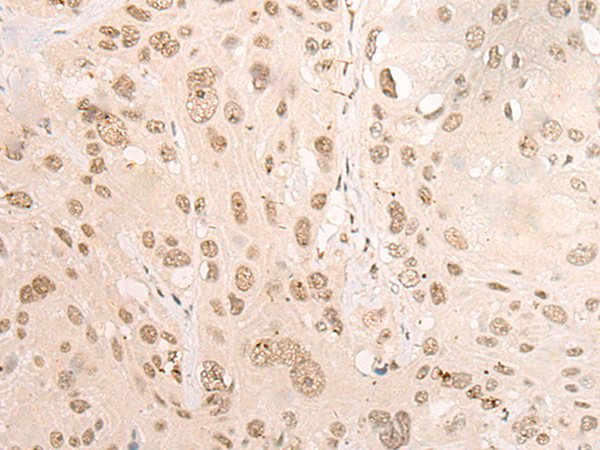 Rabbit Polyclonal Antibody to DDX3X