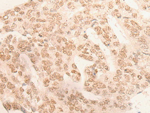 Rabbit Polyclonal Antibody to DDX42
