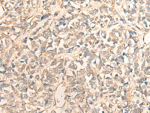 Rabbit Polyclonal Antibody to DDX50