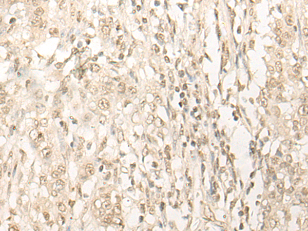 Rabbit Polyclonal Antibody to DDX52