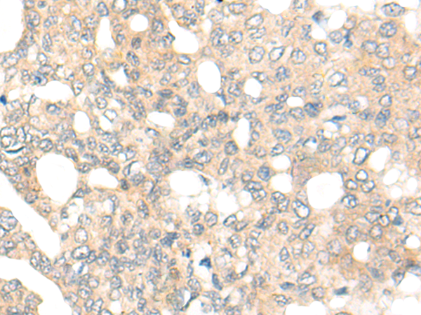 Rabbit Polyclonal Antibody to DEF8
