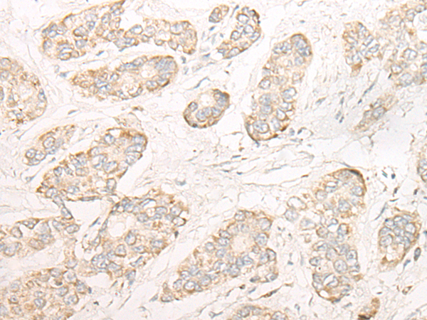 Rabbit Polyclonal Antibody to SGCA