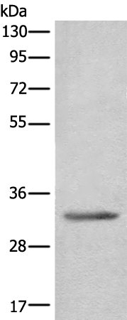 Rabbit Polyclonal Antibody to SGCD