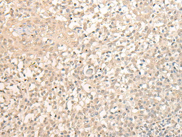 Rabbit Polyclonal Antibody to EXO5