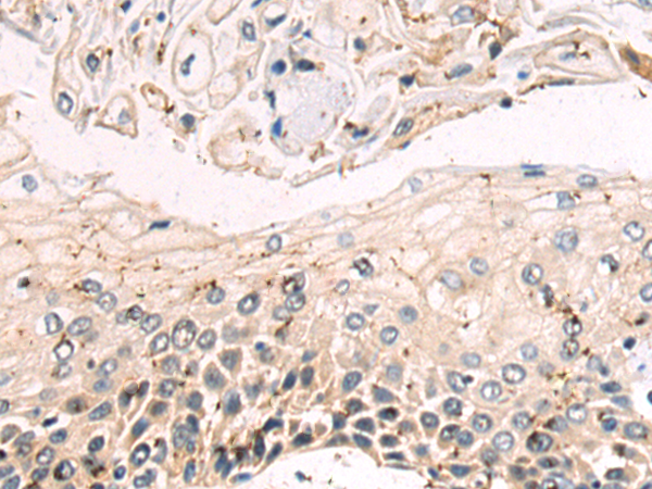 Rabbit Polyclonal Antibody to DENND1B