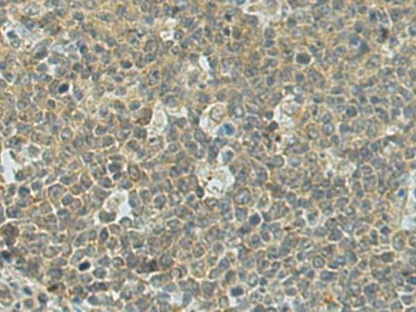 Rabbit Polyclonal Antibody to DENND1A