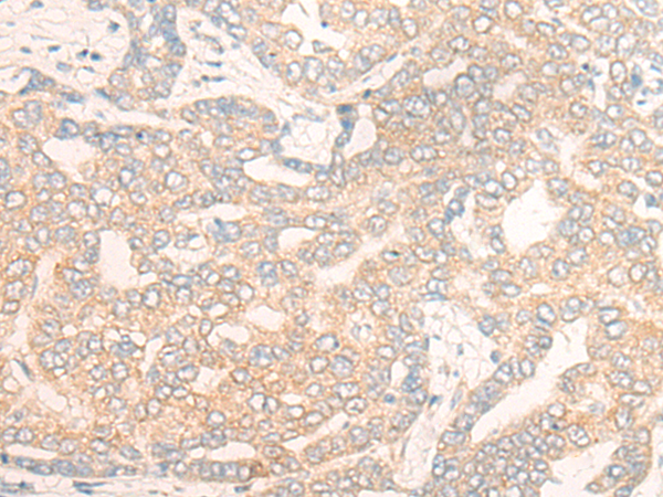 Rabbit Polyclonal Antibody to DENND5A