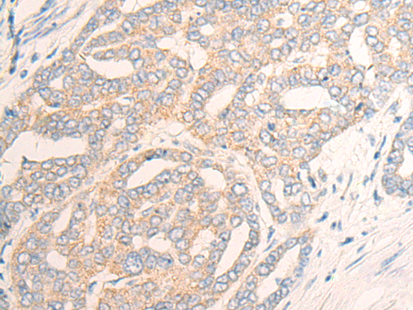 Rabbit Polyclonal Antibody to DPT