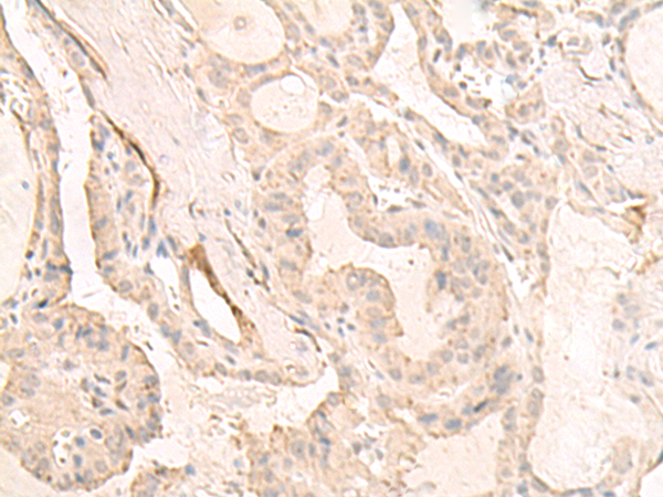 Rabbit Polyclonal Antibody to DCD