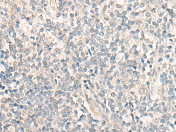Rabbit Polyclonal Antibody to GSDME