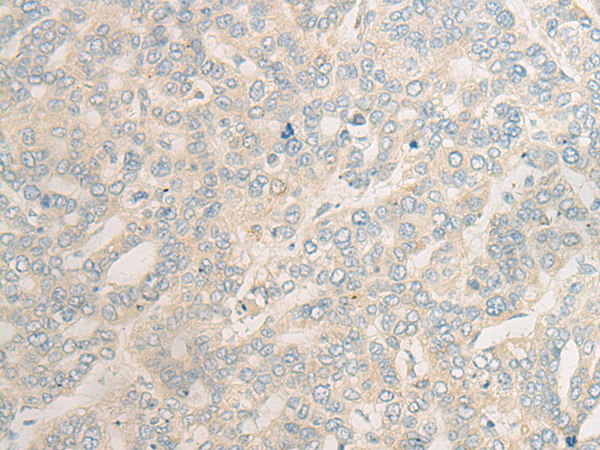 Rabbit Polyclonal Antibody to HLA-DMB