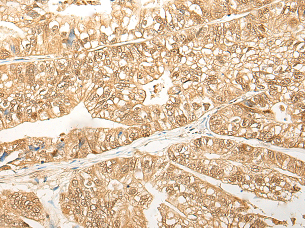 Rabbit Polyclonal Antibody to PSMB4