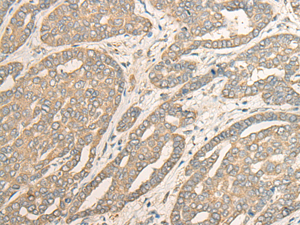 Rabbit Polyclonal Antibody to MYOZ2
