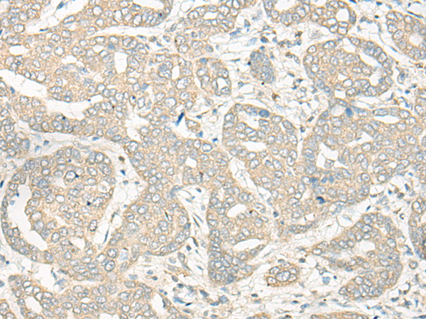 Rabbit Polyclonal Antibody to HLA-DRB5