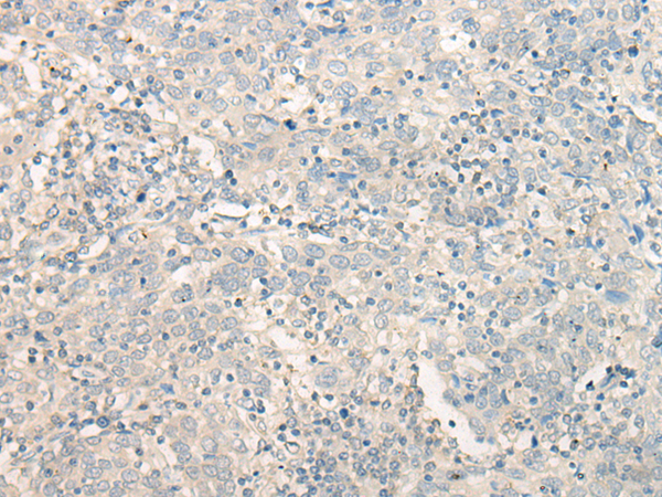 Rabbit Polyclonal Antibody to TAGAP