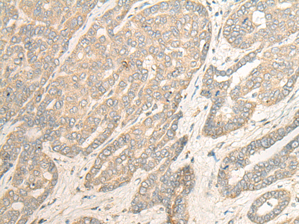 Rabbit Polyclonal Antibody to TSSK3