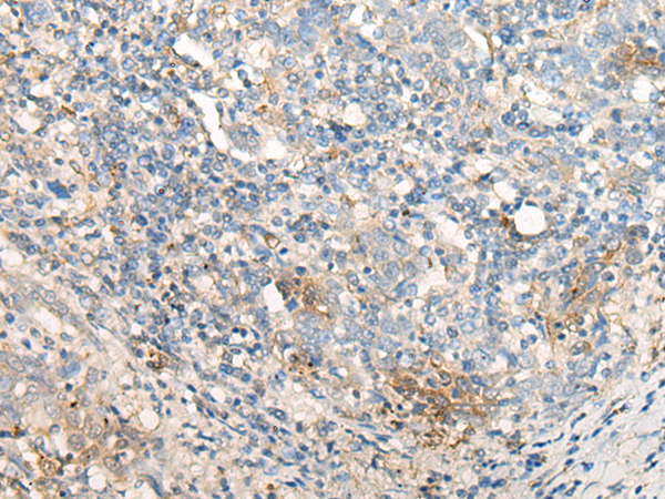 Rabbit Polyclonal Antibody to CELA3A