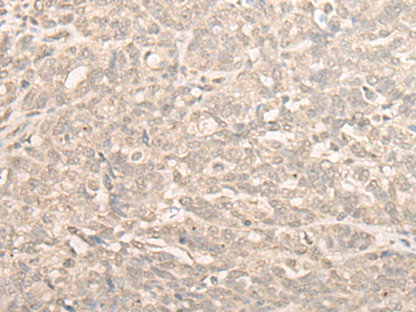 Rabbit Polyclonal Antibody to NUBP2