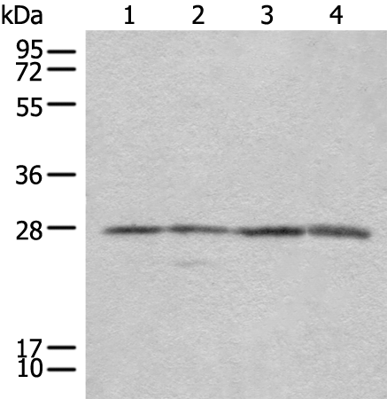 Rabbit Polyclonal Antibody to COMT