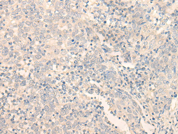 Rabbit Polyclonal Antibody to ERP27
