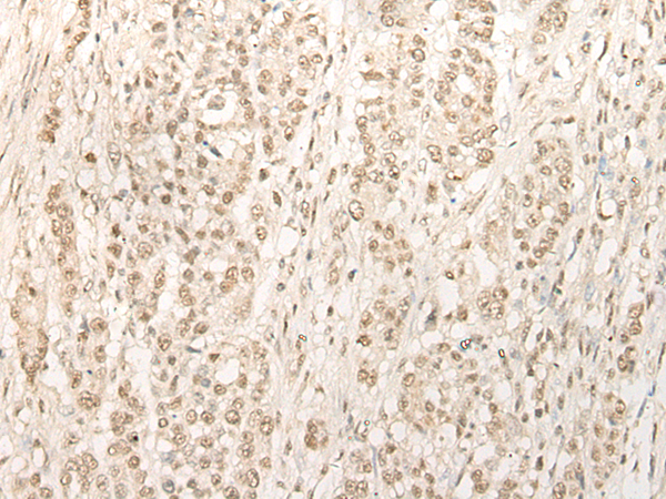 Rabbit Polyclonal Antibody to EXOSC3