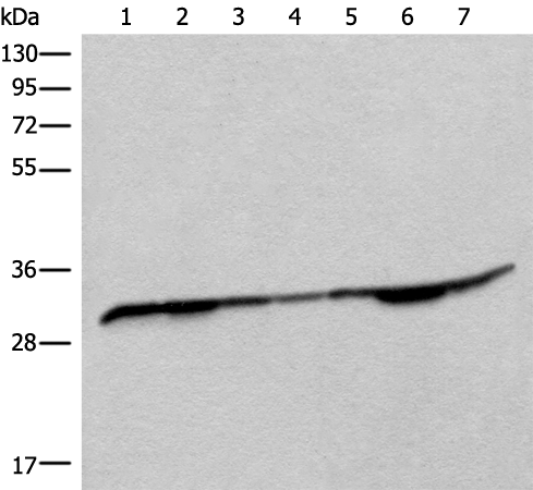 Rabbit Polyclonal Antibody to RSU1