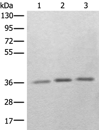 Rabbit Polyclonal Antibody to RBM11