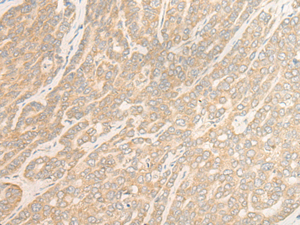 Rabbit Polyclonal Antibody to WDR6